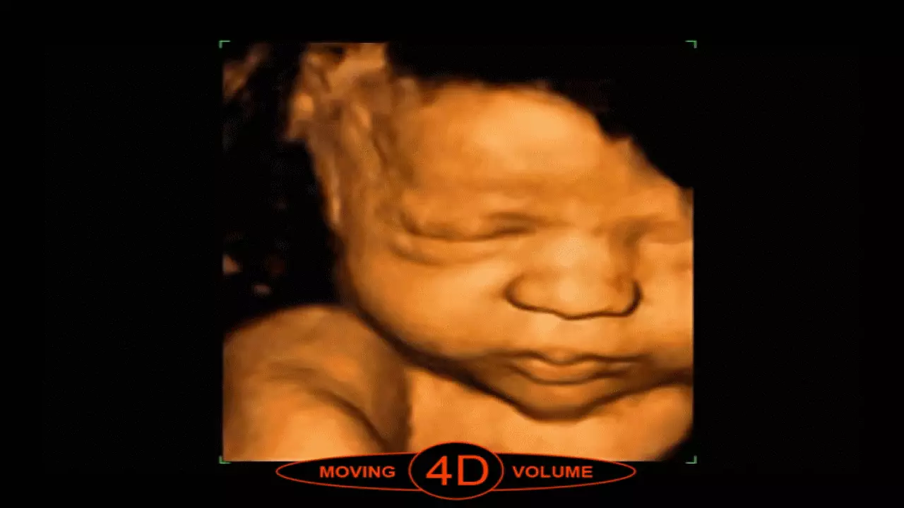Bebeğinizi 4d Ultrason ile Önceden Görebilirsiniz